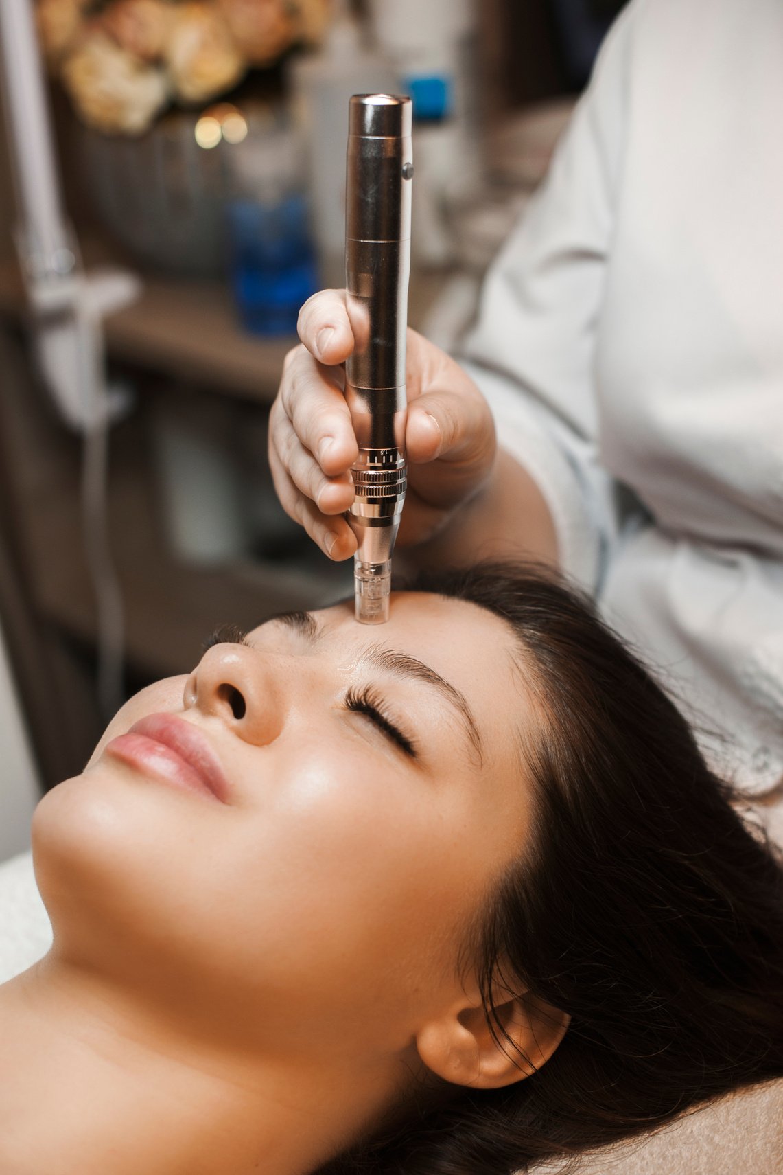 Close up portrait of a beautiful woman with dark hair with closed eyes leanin on a bed while having microneedling with dermapen by a cosmetologist.